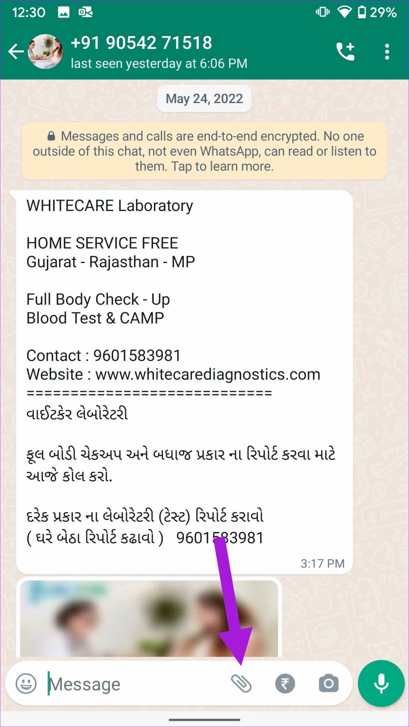 So senden Sie mehrere Fotos auf WhatsApp für iPhone und Android